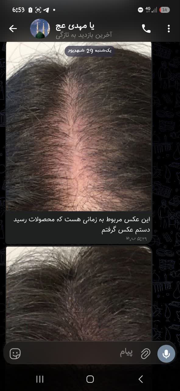 تونیک تقویت مو هرفرند دوست دار طبیعی مو بدون مایونکسیدین  ورشد طبیعی مو را افزایش میده